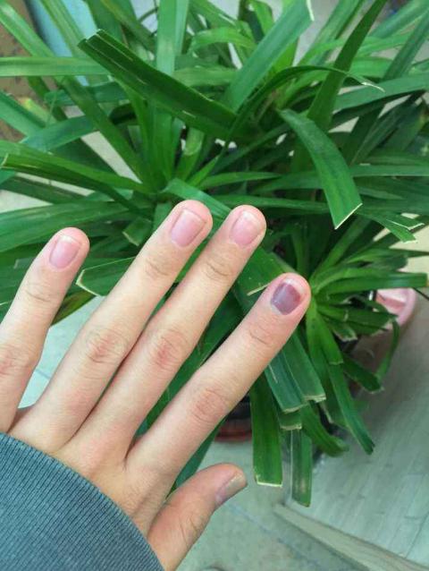 防止小孩被门夹手神器,防小孩门夹手神器