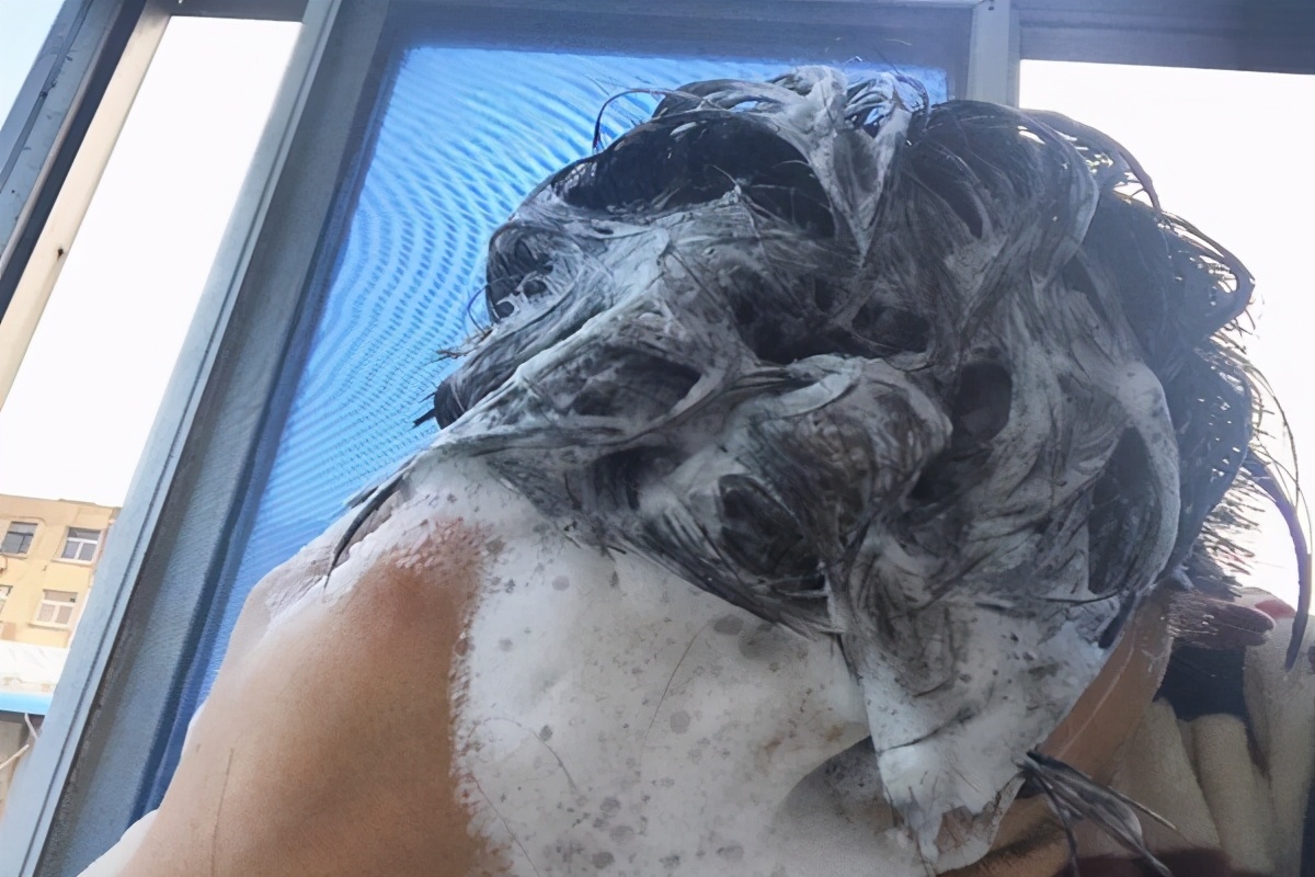 头上长硬硬的疙瘩要怎么消除,头上长了一粒硬硬的凸起物是什么