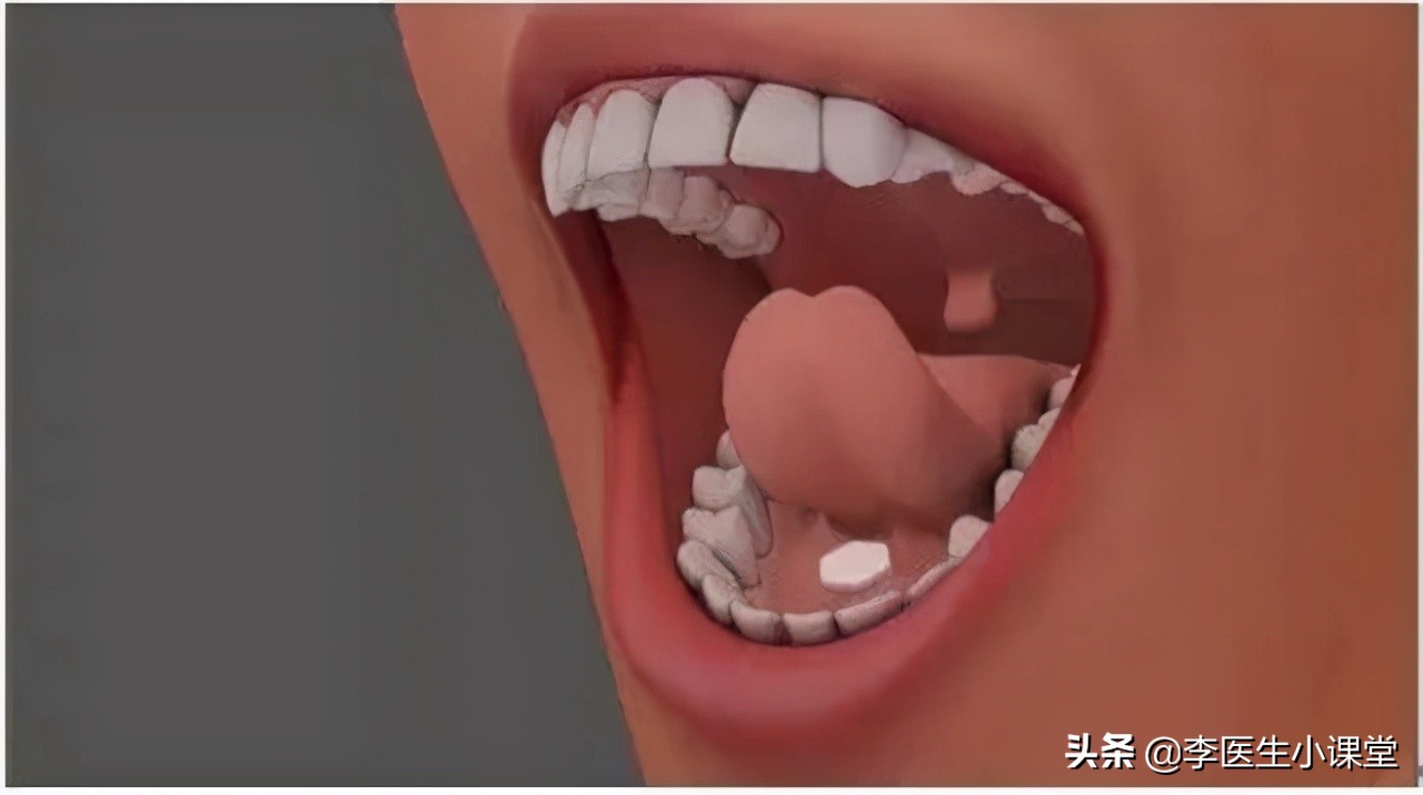 脑出血急救措施关键时刻能救命,脑出血的急救处理方法及步骤