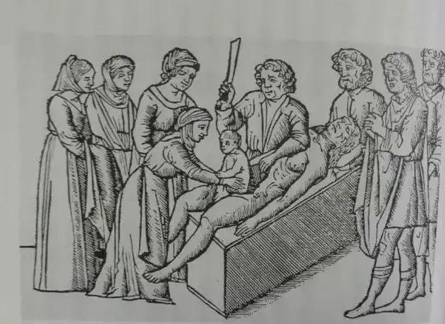 没有麻醉会疼死吗,无麻醉手术有多可怕