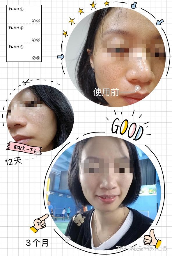 烟酰胺浓度不是越高越好，你知道么？