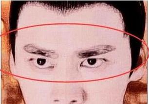 关于下睑下至，到底做还是不做？美之峰解灿告诉你