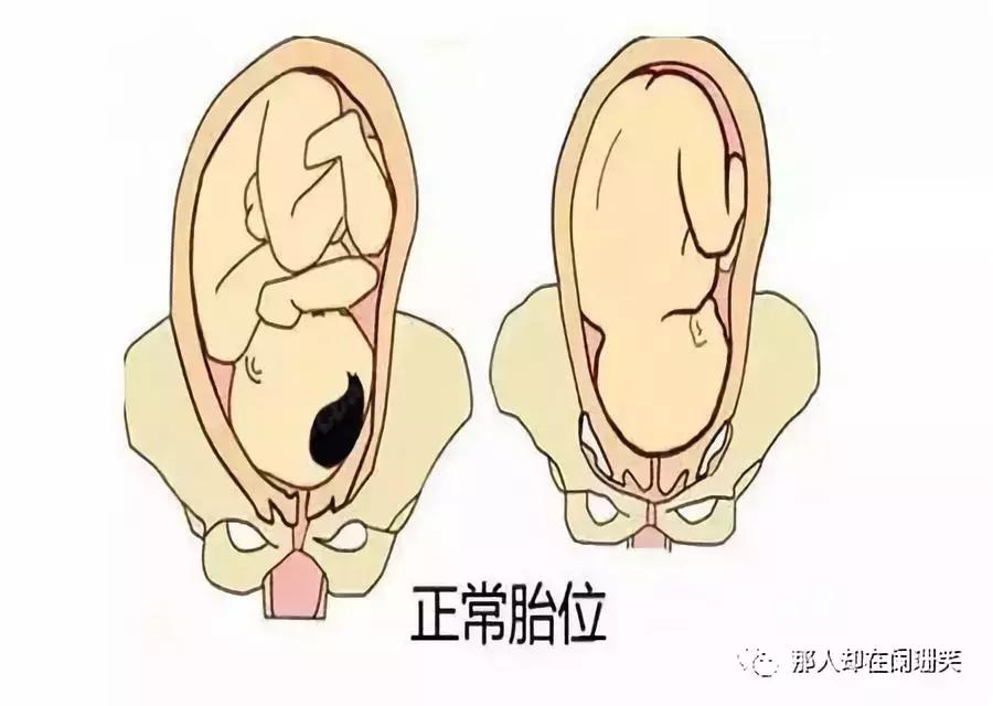 胎儿头位和右位的区别,胎儿头位和头位低的区别