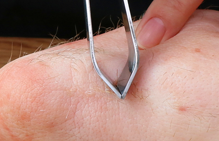 猪皮上有猪毛怎么弄干净,怎样去猪皮上的猪毛最快最有效