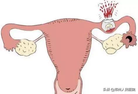 灵珠和魔丸怎么玩,魔丸和灵珠合起来是什么