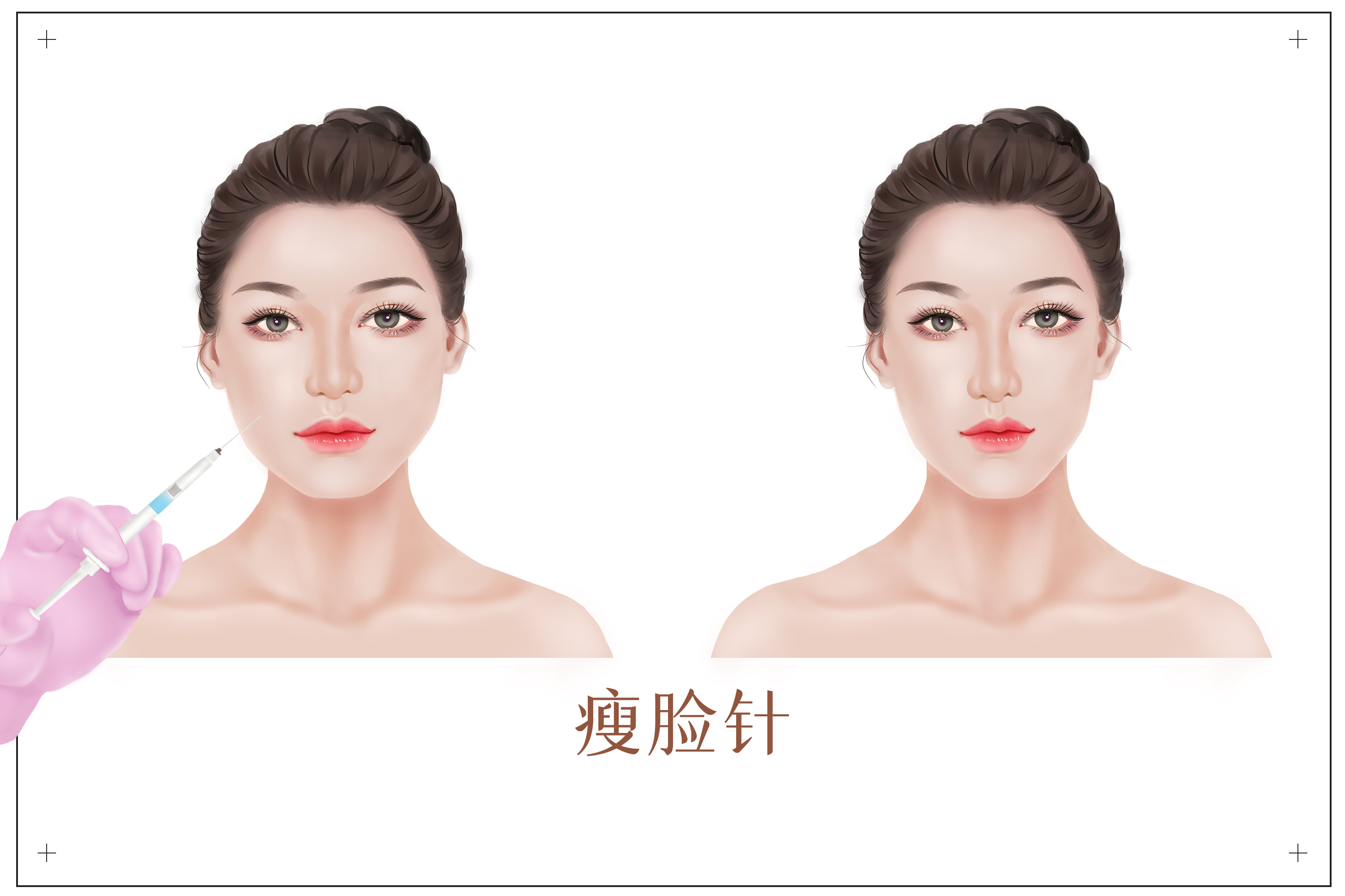 医美谣言,警惕医美骗局请勿轻易相信