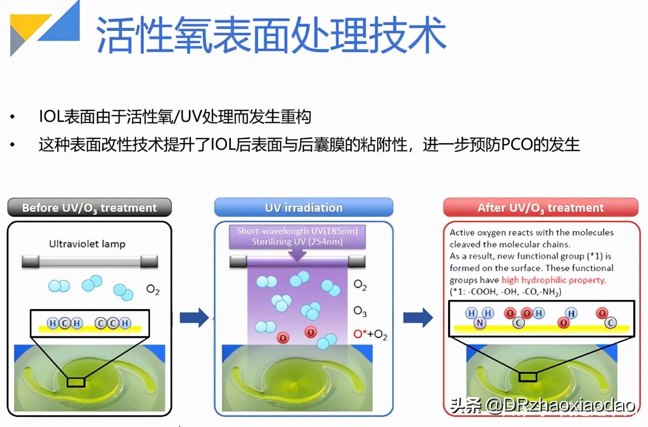 白内障手术应该如何选择人工晶体？人工晶体有什么不同