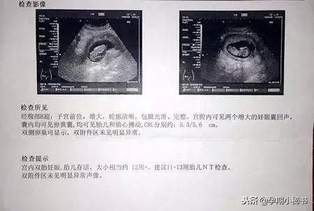 孕期产检必做的几大项,孕期第几周检查大排畸