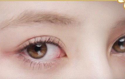 眼睛变大的方法用五天,眼睛变大有方法吗