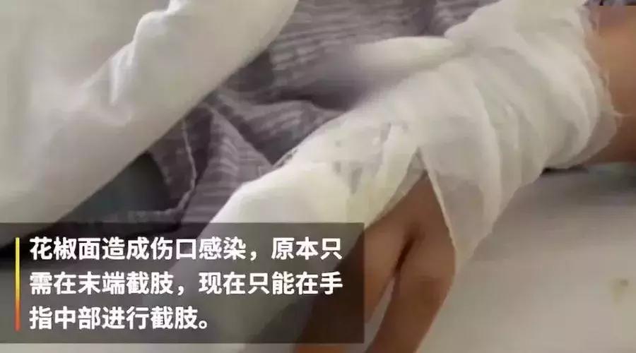 偏方差点害了孩子,这些偏方你教过孩子吗