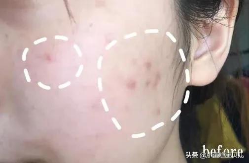 床单久睡不晒螨虫“成堆”？教你1招，不用洗不用晒，轻松除螨虫