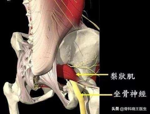屁股大腿疼是腰椎哪节引起的,屁股疼检查没有问题是什么原因