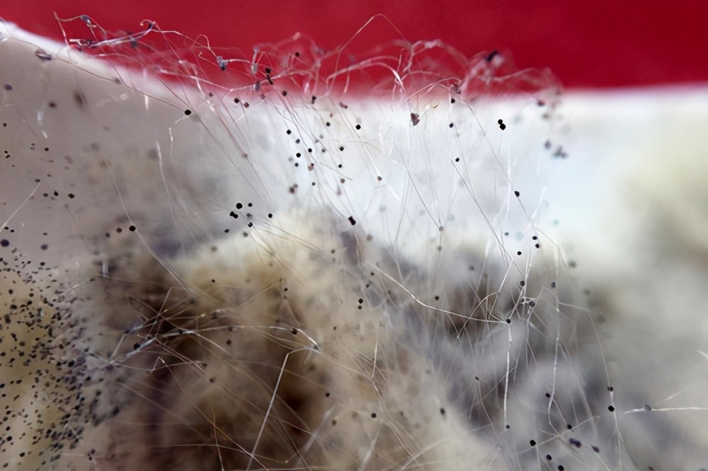 细菌感染眼球摘除,眼球摘除会不会再次真菌感染