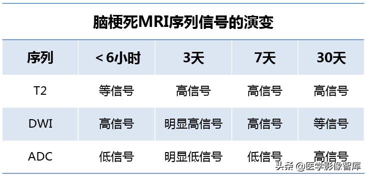 双侧额叶皮层区dwi偏高是什么意思,颅内dwi高信号病变