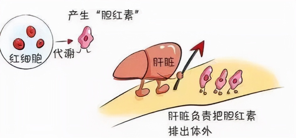 阻塞性黄疸怎么保守治疗,阻塞性黄疸凝血功能降落