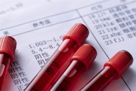 类风湿因子高关节不疼,类风湿因子高怎么样能降下来