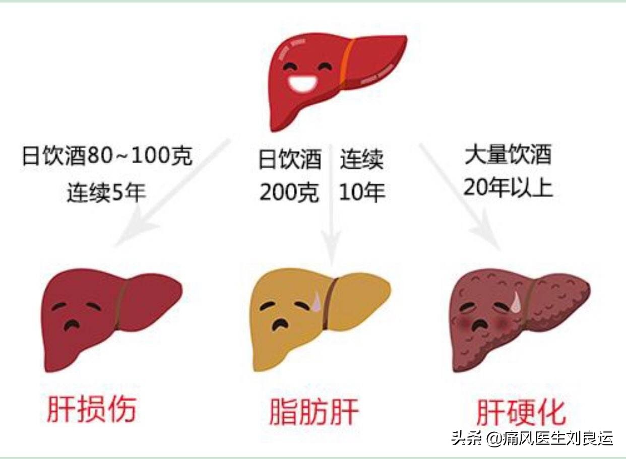 痛风患者除了不能喝啤酒，别的酒都可以喝？医生说，戒酒不香吗？