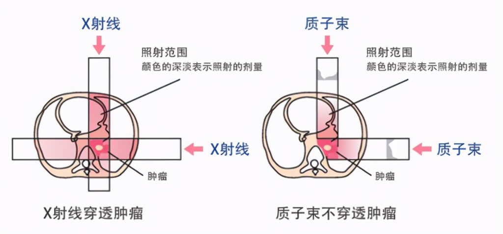 李宗伟治疗癌症花了多少钱,李宗伟患的是什么癌如何治愈