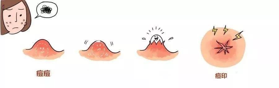 痘痘痘印怎么消除小妙招,痘痘红痘印黑痘印怎么修复