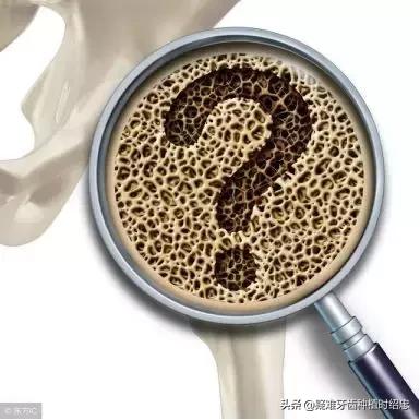 老人也可能种植牙齿吗,老年人骨质疏松能种牙吗