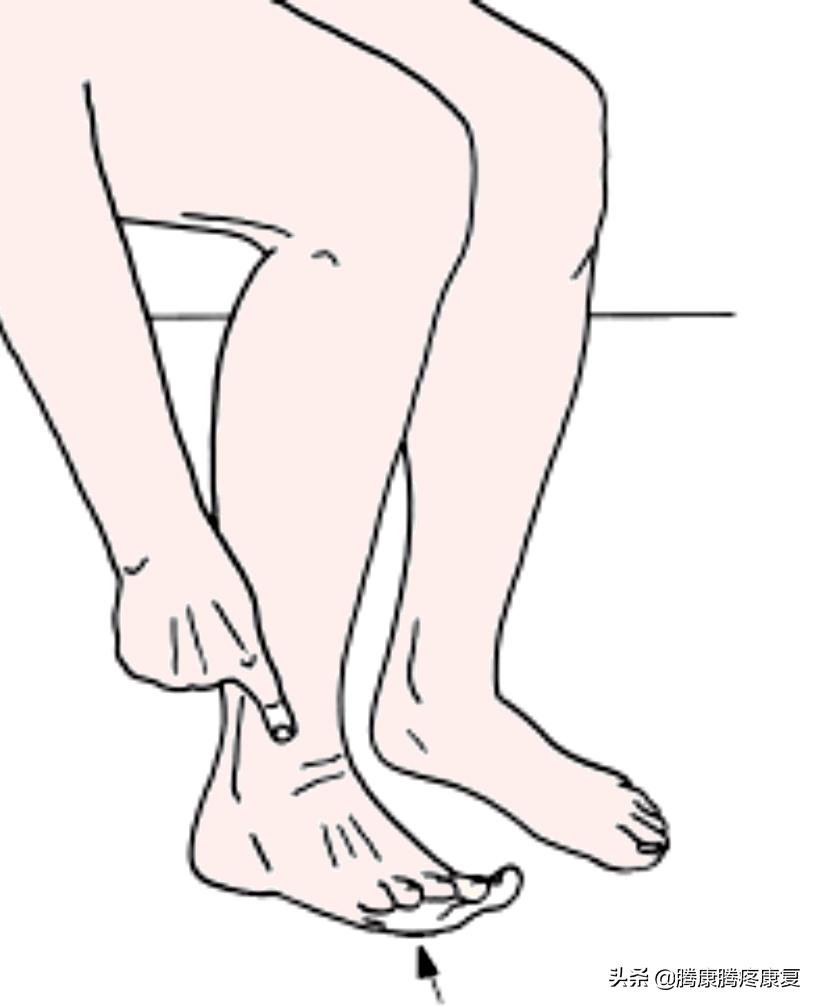 足外翻如何按摩腓骨长肌儿童,足外翻怎样调整腓骨长肌