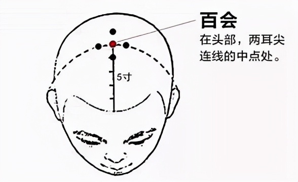 中风偏瘫半身不遂治疗方法有哪些,补阳还五汤治中风后遗症半身不遂