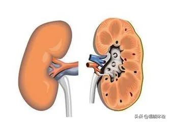 体检发现肾囊肿不要怕,体检肾囊肿要关注什么