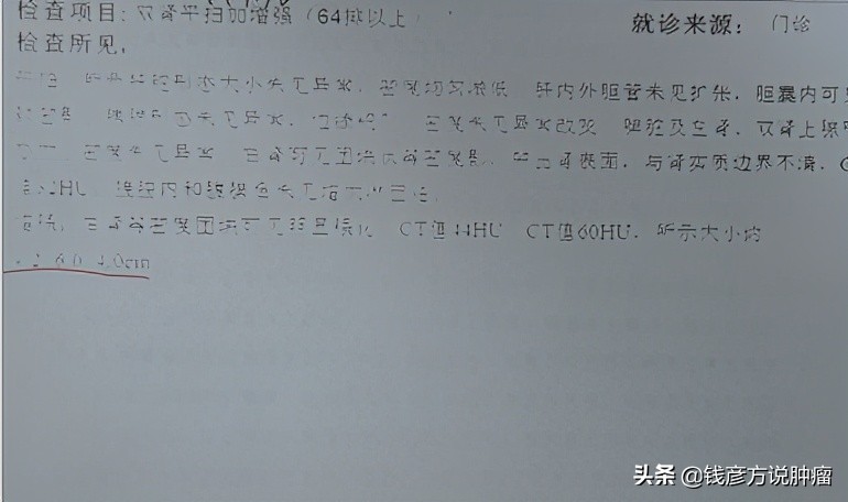 肾癌早期的6个防癌方法,肾癌中度