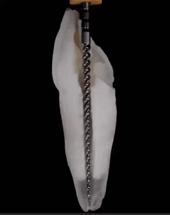 牙齿根管治疗全过程牙髓有个洞,牙髓一旦暴露就必须做根管治疗吗