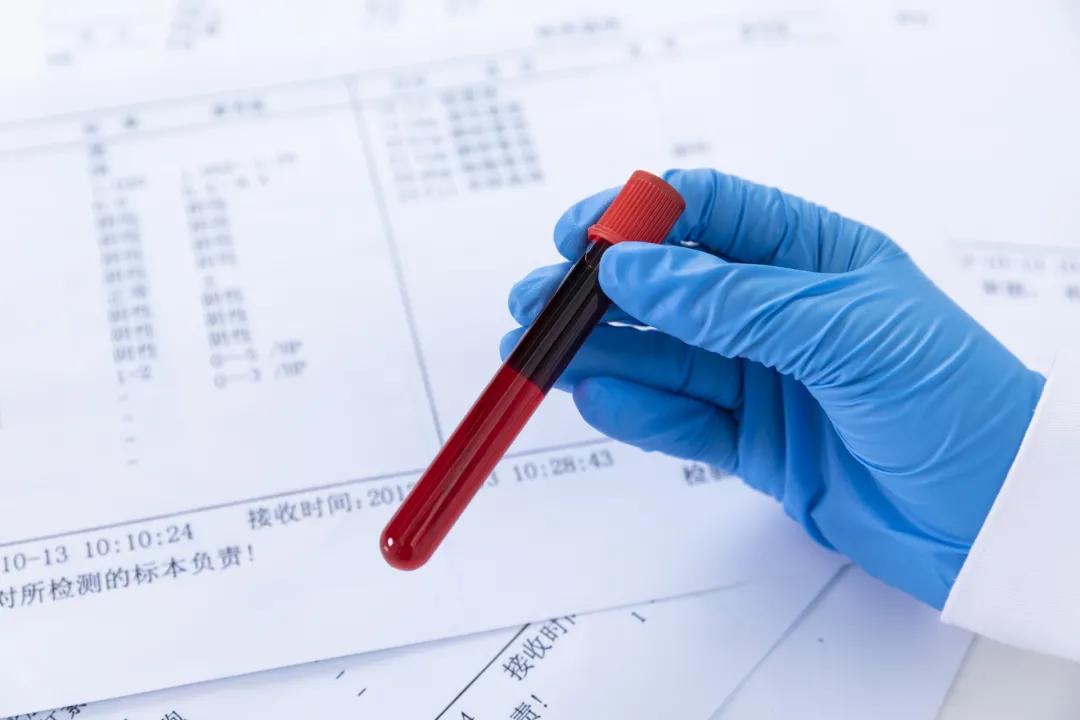 为什么你比别人怕冷,有什么办法能缓解特别怕冷