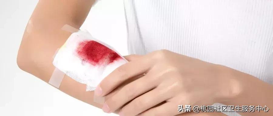 手被不锈钢划伤要打碎伤风吗,手指被刀划伤了要不要打碎伤风针