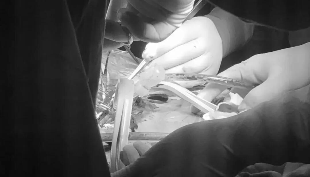 男人不难：男同胞功能障碍怎么办？（4）--治疗篇（治疗原则）