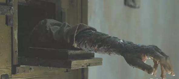 《权力的游戏》：可怕的灰鳞病