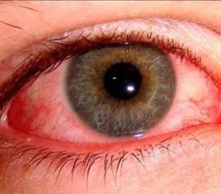 黄贵生针灸讲座全集,黄贵生巨灵针灸全集