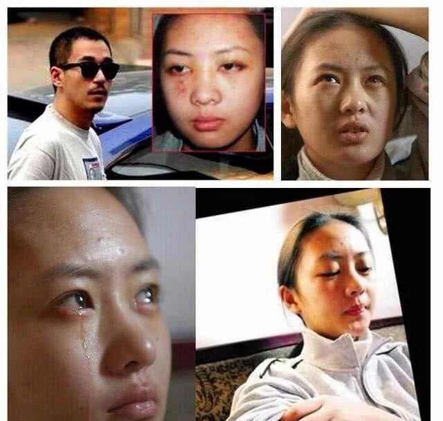 张默暴打童瑶事件后续,张默打童瑶事件瞬间