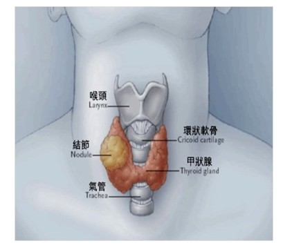 甲状腺术后要终生吃优甲乐吗,甲状腺全切终生服用优甲乐