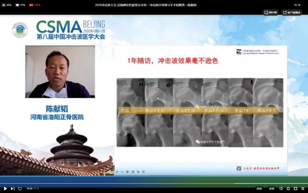 边缘硬化性股骨头坏死：冲击波疗效堪与手术相媲美