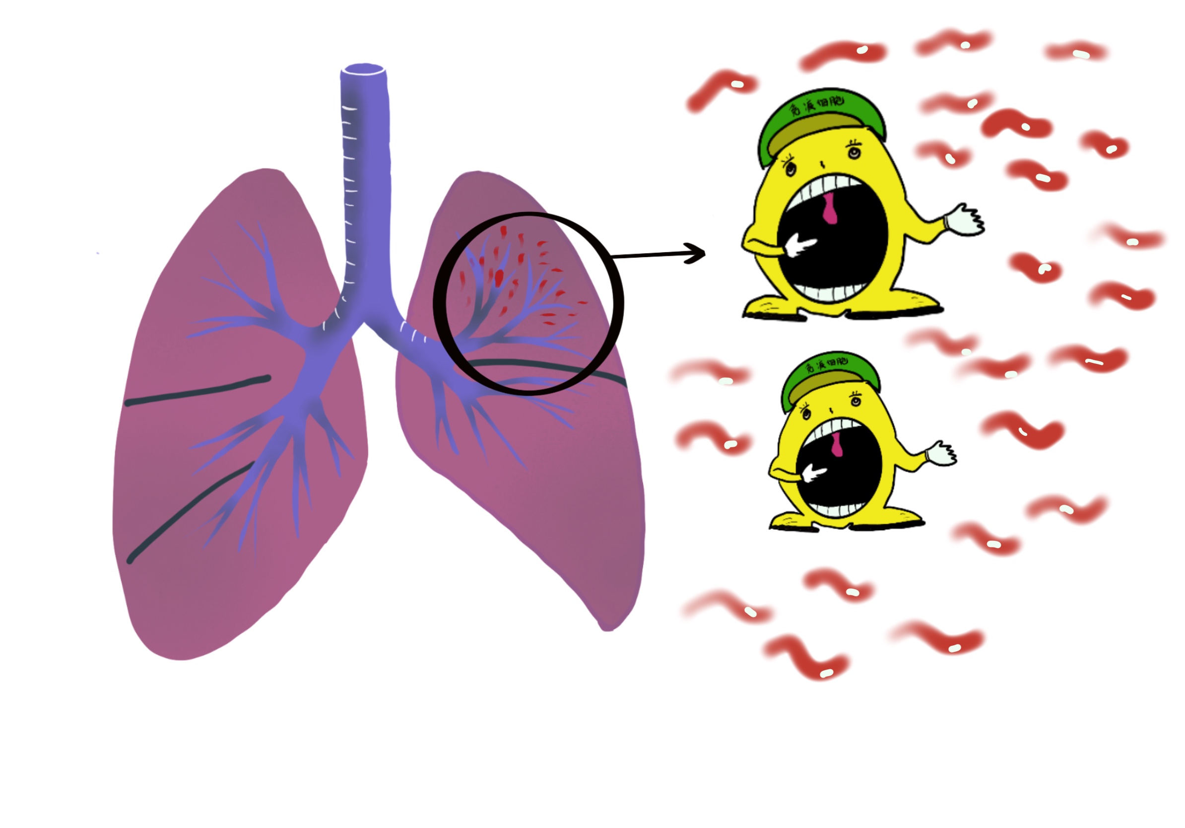 世界防治结核病日历史,世界结核病日来历