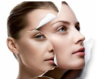 光子嫩肤bb光的区别,光子嫩肤bbl和dpl