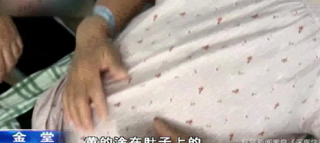 使用美容产品后休克住院，我们应当如何维权，律师：看情况决定