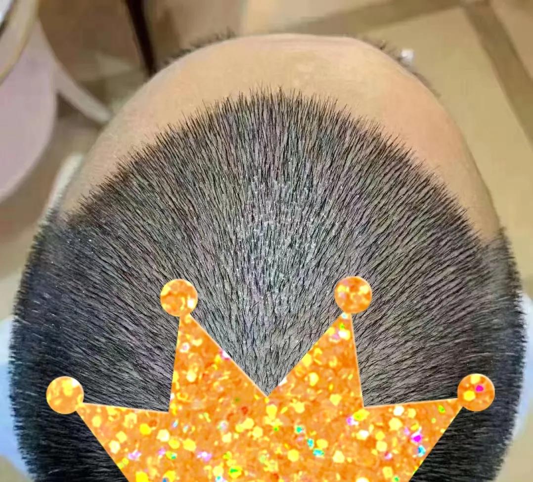 吃什么能使头发变得乌黑又浓密,吃什么可以使头发浓密