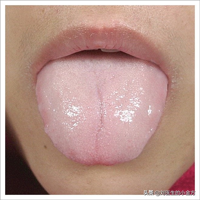 中医舌诊对照表100例,舌诊辨九大体质