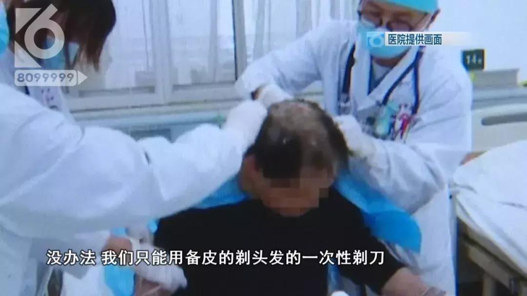 大哥敌敌畏洗头,敌敌畏洗头以毒攻毒的视频