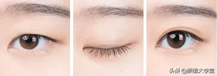 长期贴双眼皮的危害,贴几次双眼皮贴会导致眼皮松弛