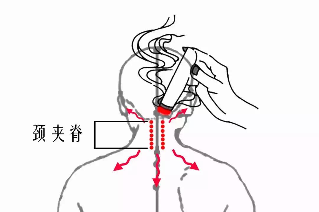 颈椎腰腿痛针刀,针刀颈椎病