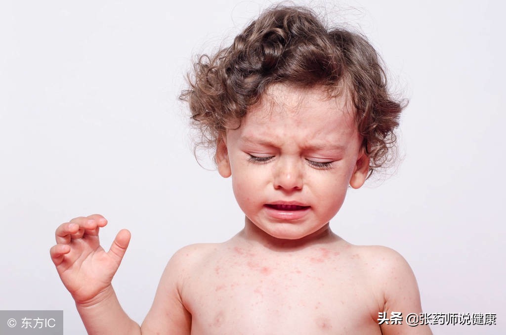 小孩有鼻炎一到冬天就流鼻血,小朋友过敏性鼻炎最近经常流鼻血