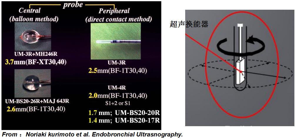 全球对肺癌治疗的最有效最新技术,肺癌的支气管镜介入治疗