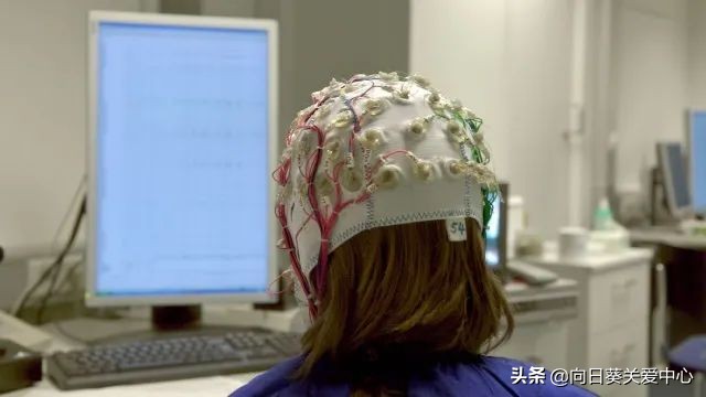 癫痫病人的家庭如何护理,如何防止小儿癫痫发作