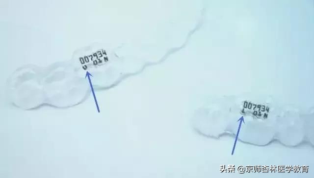 戴过的隐形牙套怎么收纳,隐形牙套随身携带清理