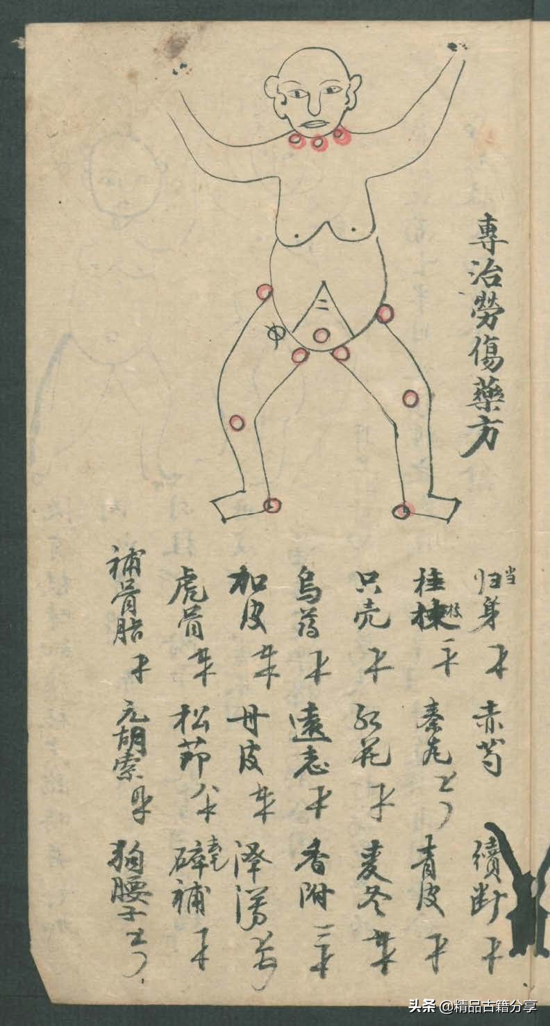 中医类抄本跌打损伤方面的医书欢迎阅读
